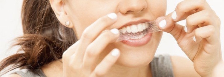アメリカでの歯のホワイトニング事情 ホームホワイトニングが人気 Amenew Dreams